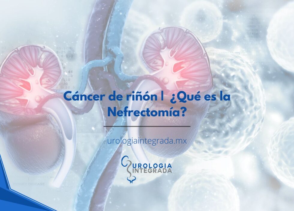 Urólogo en Guadalajara | Consulta Especializada en Zapopan